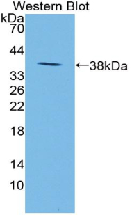 Neuropeptide S / NPS Antibody - Western blot of Neuropeptide S / NPS antibody.