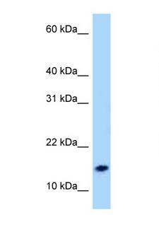 Neuropeptide S / NPS Antibody - NPS / Neuropeptide S antibody Western blot of MCF7 Cell lysate. Antibody concentration 1 ug/ml.  This image was taken for the unconjugated form of this product. Other forms have not been tested.