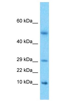 Neuropeptide Y / NPY Antibody - Neuropeptide Y / NPY antibody Western Blot of Esophagus Tumor. Antibody dilution: 1 ug/ml.  This image was taken for the unconjugated form of this product. Other forms have not been tested.