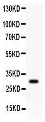 Neuropeptide Y / NPY Antibody - Neuropeptide Y antibody Western blot. All lanes: Anti Neuropeptide Y at 0.5 ug/ml. WB: COLO320 Whole Cell Lysate at 40 ug. Predicted band size: 11 kD. Observed band size: 30 kD.