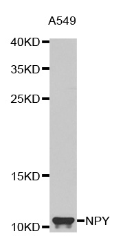 Neuropeptide Y / NPY Antibody - Western blot analysis of extracts of A549 cells.