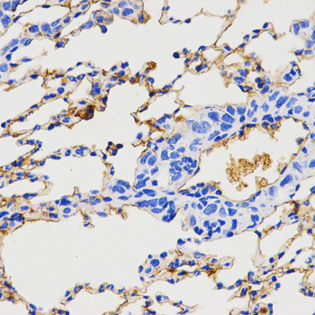 Neuropeptide Y / NPY Antibody - Immunohistochemistry of paraffin-embedded mouse lung metastasis.