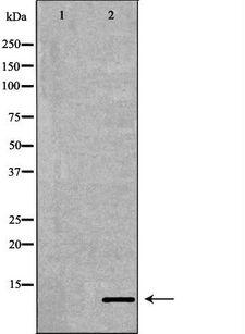 Neuropeptide Y / NPY Antibody - Western blot analysis of extracts of 293T cells using NPY antibody. The lane on the left is treated with the antigen-specific peptide.