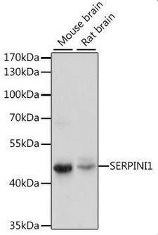 Neuroserpin Antibody - Western blot - SERPINI1 Polyclonal Antibody