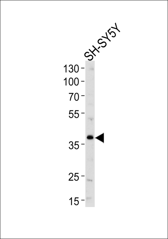 Neuroserpin Antibody - Western blot of lysate from SH-SY5Y cell line, using SERPINI1 Antibody. Antibody was diluted at 1:1000 at each lane. A goat anti-rabbit IgG H&L (HRP) at 1:5000 dilution was used as the secondary antibody. Lysate at 35ug per lane.
