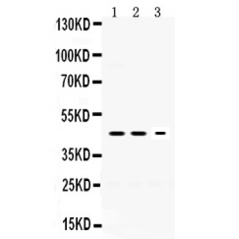 Neuroserpin Antibody - Neuroserpin antibody Western blot. All lanes: Anti Neuroserpin at 0.5 ug/ml. Lane 1: Rat Brain Tissue Lysate at 50 ug. Lane 2: Mouse Brain Tissue Lysate at 50 ug. Lane 3: PANC Whole Cell Lysate at 40 ug. Predicted band size: 46 kD. Observed band size: 46 kD.
