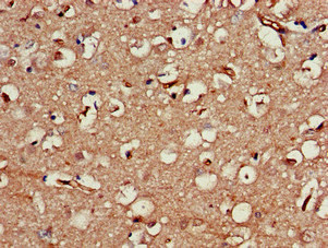 Neuroserpin Antibody - Immunohistochemistry of paraffin-embedded human brain tissue at dilution of 1:100
