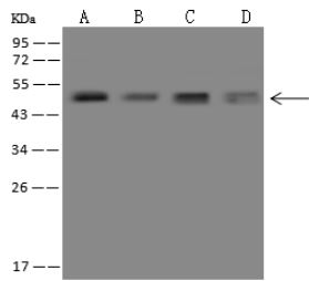 Neuroserpin Antibody - Anti-SERPINI1 rabbit polyclonal antibody at 1:500 dilution.