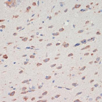 Neuroserpin Antibody - Immunohistochemistry of paraffin-embedded Rat brain using SERPINI1 Polyclonal Antibody at dilution of 1:200 (40x lens).