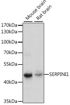 Neuroserpin Antibody - Western blot analysis of extracts of various cell lines using SERPINI1 Polyclonal Antibody at dilution of 1:1000.