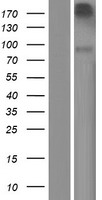 Neurotrypsin Protein - Western validation with an anti-DDK antibody * L: Control HEK293 lysate R: Over-expression lysate
