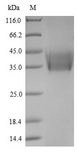 HN Protein - (Tris-Glycine gel) Discontinuous SDS-PAGE (reduced) with 5% enrichment gel and 15% separation gel.