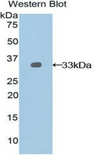 NEXN / Nexilin Antibody - Western blot of recombinant NEXN / Nexilin.  This image was taken for the unconjugated form of this product. Other forms have not been tested.