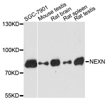 NEXN / Nexilin Antibody - Western blot analysis of extracts of various cell lines, using NEXN antibody at 1:3000 dilution. The secondary antibody used was an HRP Goat Anti-Rabbit IgG (H+L) at 1:10000 dilution. Lysates were loaded 25ug per lane and 3% nonfat dry milk in TBST was used for blocking. An ECL Kit was used for detection and the exposure time was 90s.