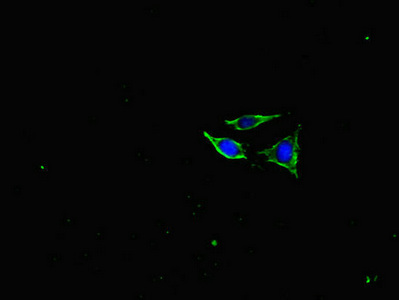 NF-L / NEFL Antibody - Immunofluorescent analysis of SH-SY5Y cells diluted at 1:100 and Alexa Fluor 488-congugated AffiniPure Goat Anti-Rabbit IgG(H+L)