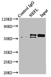 NF-L / NEFL Antibody - Immunoprecipitating NEFL in mouse brain tissue Lane 1: Rabbit control IgG instead of NEFL Antibody in mouse brain tissue.For western blotting, a HRP-conjugated Protein G antibody was used as the secondary antibody (1/2000) Lane 2: NEFL Antibody (8µg) + Mouse brain tissue (500µg) Lane 3: Mouse brain tissue (10µg)