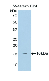 NF-L / NEFL Antibody - Western blot of recombinant NF-L / NEFL.  This image was taken for the unconjugated form of this product. Other forms have not been tested.