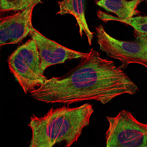NF-L / NEFL Antibody - Immunofluorescence of HeLa cells using NEFL mouse monoclonal antibody (green). Blue: DRAQ5 fluorescent DNA dye. Red: Actin filaments have been labeled with Alexa Fluor-555 phalloidin.