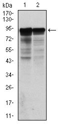 NF-L / NEFL Antibody - NEFL Antibody in Western Blot (WB)