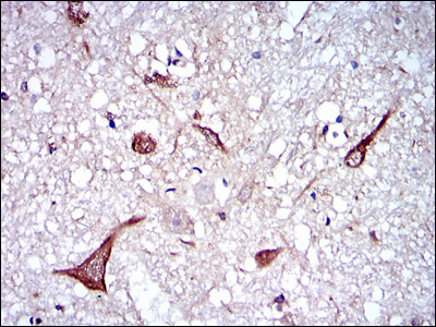NF-L / NEFL Antibody - IHC of paraffin-embedded brain tissues using NEFL mouse monoclonal antibody with DAB staining.
