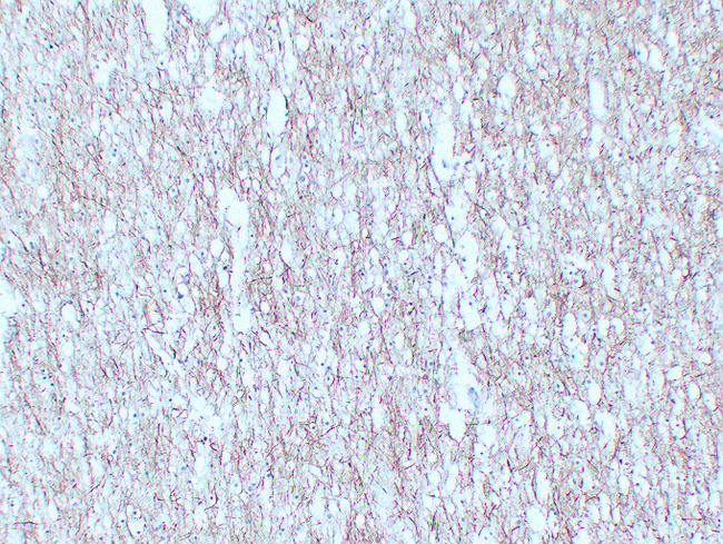 NF-L / NEFL Antibody - Brain 1
