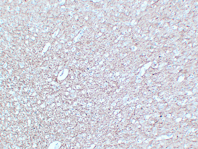NF-L / NEFL Antibody - Brain 2