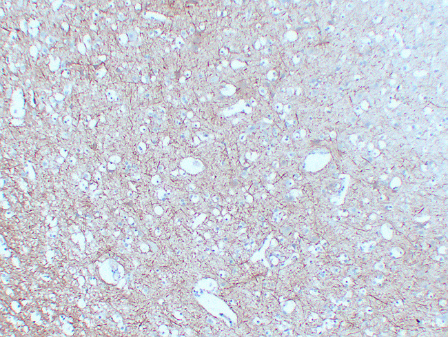 NF-L / NEFL Antibody - Brain 3
