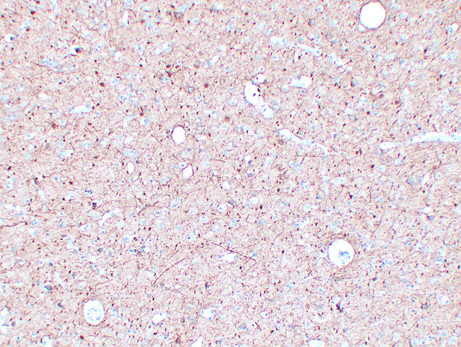 NF-L / NEFL Antibody - Brain 4
