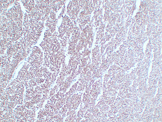 NF-L / NEFL Antibody - Hippocampus 1