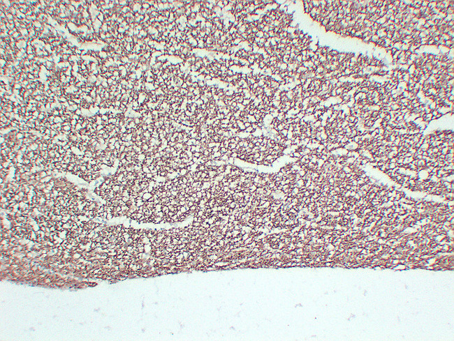 NF-L / NEFL Antibody - Hippocampus 2