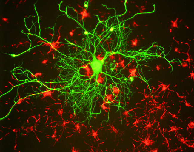 NF-L / NEFL Antibody - Cells grown from adult rat brain using method described by Evans et al. (2). Large cell in middle is stained with mouse monoclonal to NF-L clone DA2 (green). Another type of neuronal lineage cell was stained with rabbit polyclonal to alpha-internexin RPCA-a-Int (red). These cells were mitotic but had several characteristics of neurons.