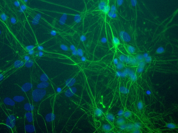 NF-L / NEFL Antibody - Neurofilament staining of cultured neurons (green) with the Neurofilament light chain antibody. Nuclei are stained blue.
