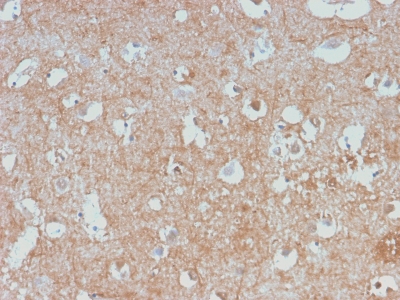 NF-L / NEFL Antibody - Formalin-fixed, paraffin-embedded human Cerebellum stained with Neurofilament Rabbit Monoclonal Antibody (NEFL/2983R).