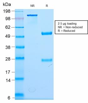 NF-L / NEFL Antibody - SDS-PAGE Analysis Purified Neurofilament Rabbit Monoclonal Antibody (NEFL/2983R). Confirmation of Purity and Integrity of Antibody.