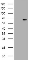 NF-L / NEFL Antibody - HEK293T cells were transfected with the pCMV6-ENTRY control (Left lane) or pCMV6-ENTRY NEFL (Right lane) cDNA for 48 hrs and lysed. Equivalent amounts of cell lysates (5 ug per lane) were separated by SDS-PAGE and immunoblotted with anti-NEFL.
