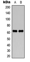 NF-L / NEFL Antibody - Western blot analysis of NEFL expression in Jurkat (A); NIH3T3 (B) whole cell lysates.