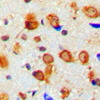 NF-L / NEFL Antibody - Immunohistochemical analysis of NEFL staining in human brain formalin fixed paraffin embedded tissue section. The section was pre-treated using heat mediated antigen retrieval with sodium citrate buffer (pH 6.0). The section was then incubated with the antibody at room temperature and detected using an HRP conjugated compact polymer system. DAB was used as the chromogen. The section was then counterstained with hematoxylin and mounted with DPX.