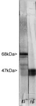 NF-L / NEFL Antibody - Western blot of whole rat cerebellum homogenate stained with NF-L / NEFL antibody in the left strip, at dilution of 1:20,000. A prominent band running with an apparent SDS-PAGE molecular weight of ~68kDa corresponds to rodent NF-L. Faint bands below this are in vivo degradation products generated by calpain digestion. The major NF-H band in human, cow and bovine run a little slower on SDS-PAGE, at about 70kDa. Right lane shows a strip incubated with a new antibody against neuron specific enolase, which reveals a major band at 47kDa.