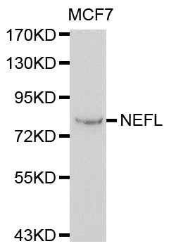 NF-L / NEFL Antibody - Western blot analysis of extracts of MCF-7 cells, using NEFL antibody at 1:1000 dilution. The secondary antibody used was an HRP Goat Anti-Rabbit IgG (H+L) at 1:10000 dilution. Lysates were loaded 25ug per lane and 3% nonfat dry milk in TBST was used for blocking.