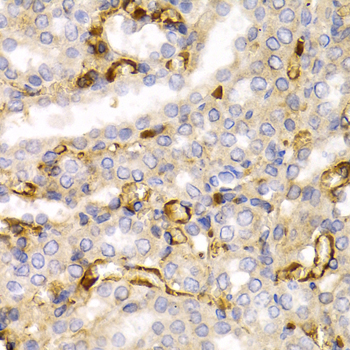 NF-L / NEFL Antibody - Immunohistochemistry of paraffin-embedded rat kidney using NEFL antibodyat dilution of 1:200 (40x lens).