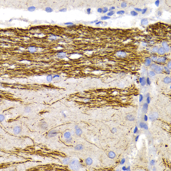 NF-L / NEFL Antibody - Immunohistochemistry of paraffin-embedded rat brain using NEFL antibodyat dilution of 1:200 (40x lens).