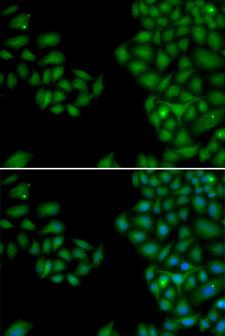 NF-L / NEFL Antibody - Immunofluorescence analysis of HeLa cells using NEFL antibody. Blue: DAPI for nuclear staining.