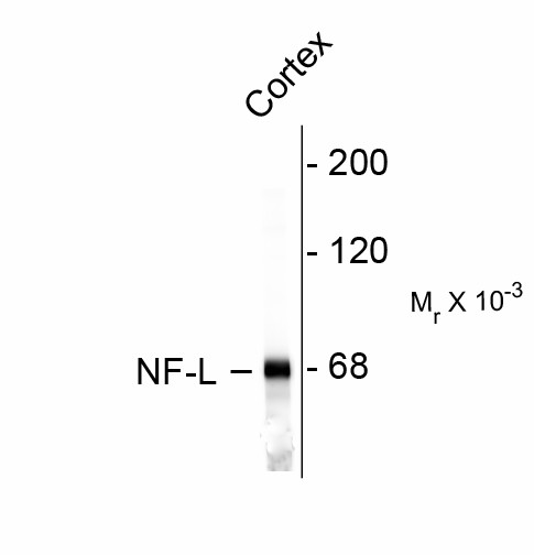 NF-L / NEFL Antibody - Western blot of rat cortex lysate showing specific immunolabeling of the ~68k NF-L protein.