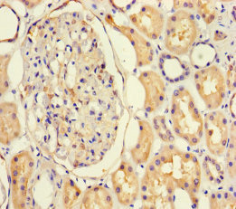 NF1A / NFIX Antibody - Immunohistochemistry of paraffin-embedded human kidney tissue using NFIX Antibody at dilution of 1:100