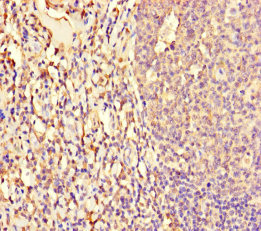 NF1A / NFIX Antibody - Immunohistochemistry of paraffin-embedded human tonsil tissue using NFIX Antibody at dilution of 1:100