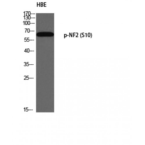 NF2 / Merlin Antibody - Western blot of Phospho-NF2 (S10) antibody
