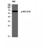 NF2 / Merlin Antibody - Western blot of Phospho-NF2 (S10) antibody