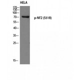 NF2 / Merlin Antibody - Western blot of Phospho-NF2 (S518) antibody