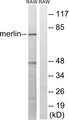 NF2 / Merlin Antibody - Western blot analysis of lysates from RAW264.7 cells, using Merlin Antibody. The lane on the right is blocked with the synthesized peptide.