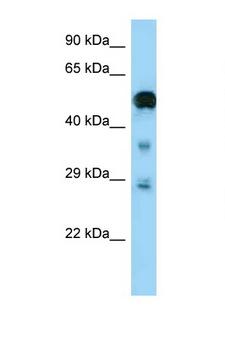 NF2 / Merlin Antibody - NF2 antibody Western blot of Fetal Brain lysate. Antibody concentration 1 ug/ml.  This image was taken for the unconjugated form of this product. Other forms have not been tested.